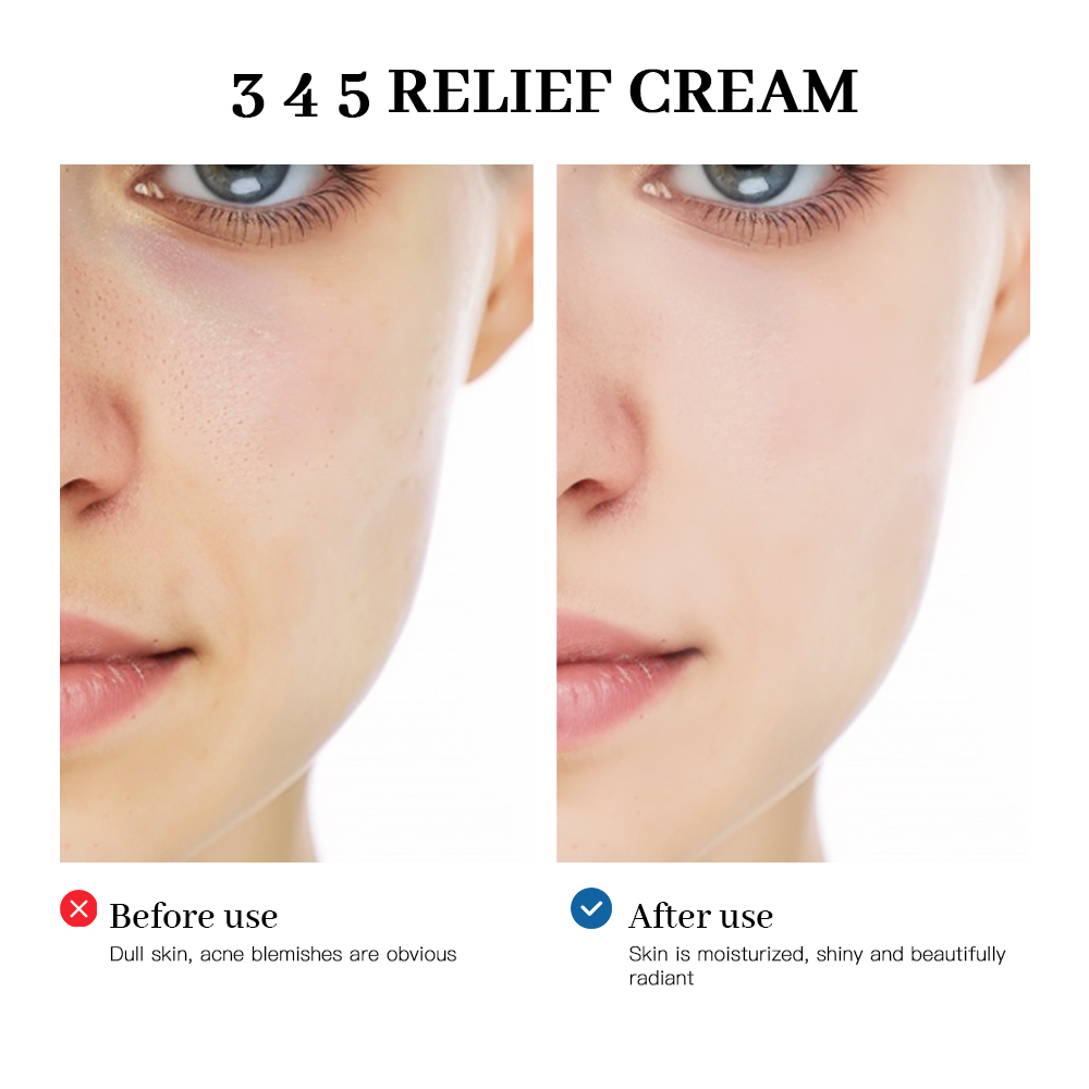 345 Relief Cream สารละลายที่คร - Healing Wellness บทวิจารณ์และราคา